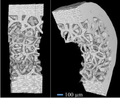 3D Printed Bone Scaffolds